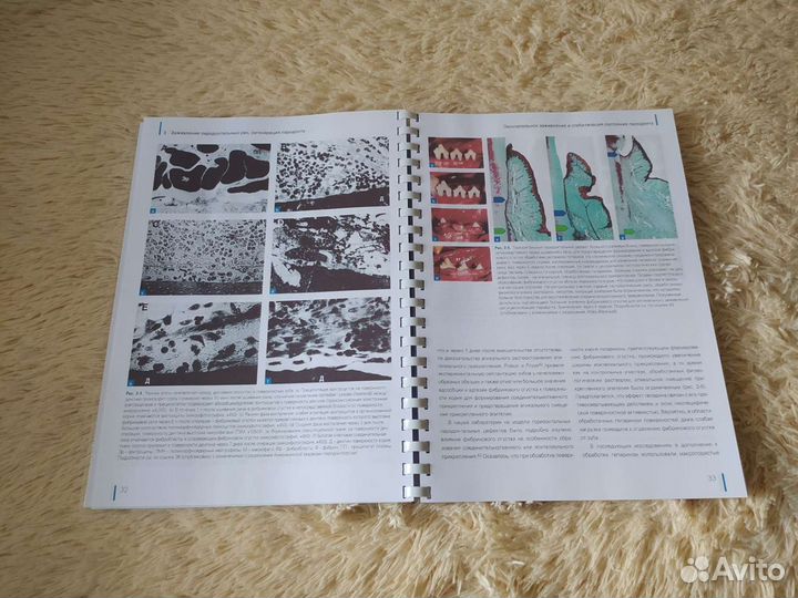 Регенерация пародонта