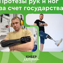 Протезы рук и н�ог