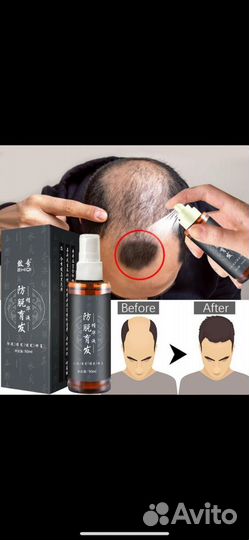 Тоник против выпадения волос