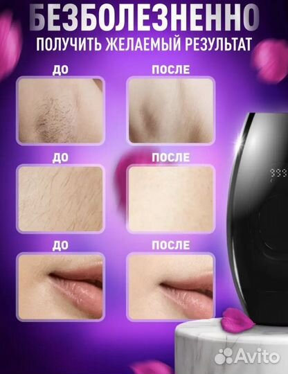 Фотоэпилятор IPL