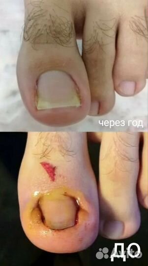 Подология,педикюр, маникюр