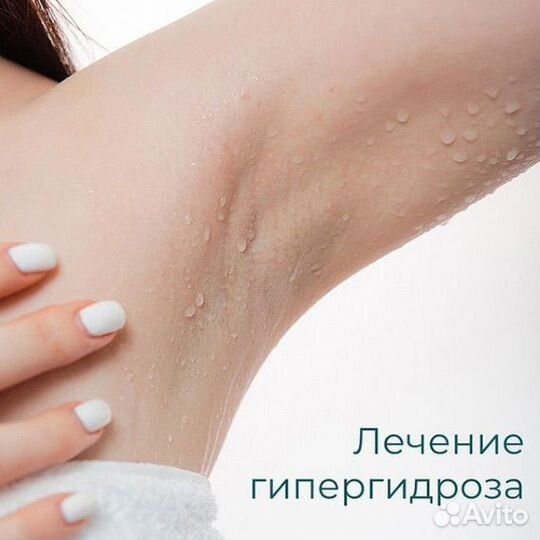 Гипергидроз (чрезмерное потоотделение)