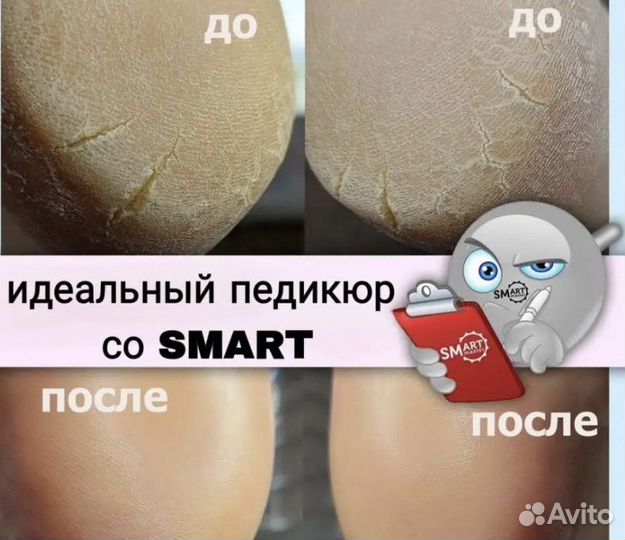 Педикюр, смарт педикюр