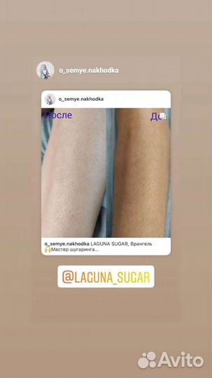 Шугаринг Врангель