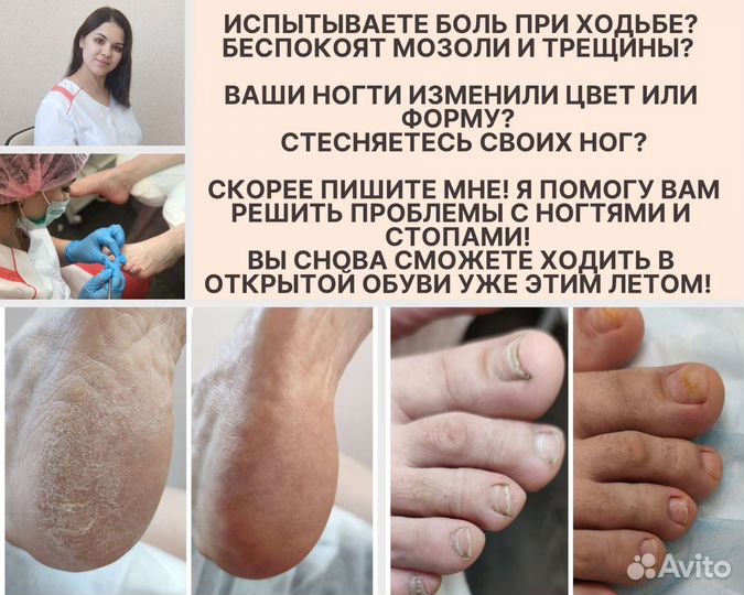 Педикюр Подолог