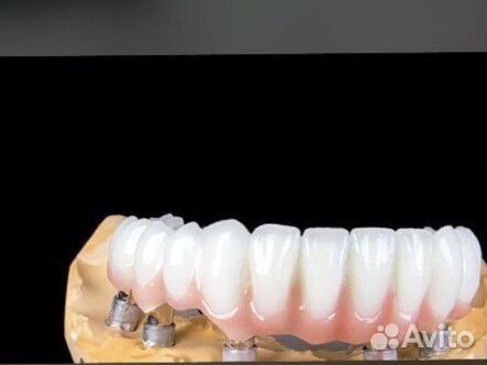 Услуги зубного техника