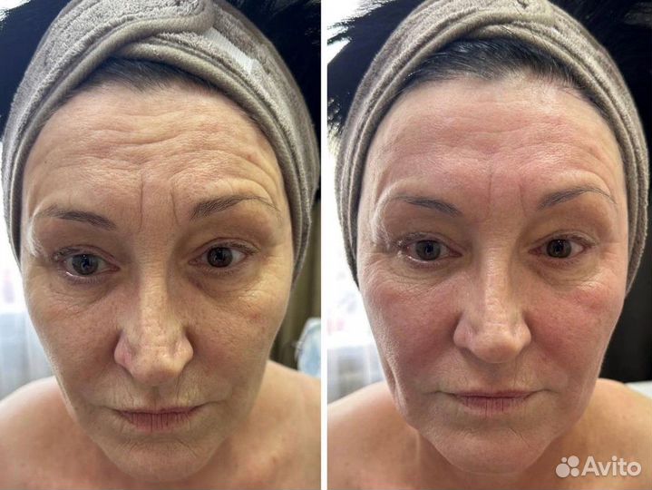 Массаж коррекция фигуры