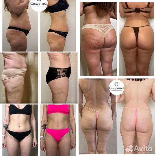 Массаж сферами