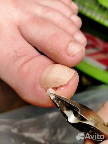 Медицинский, Смарт и Классический Педикюр/Подолог