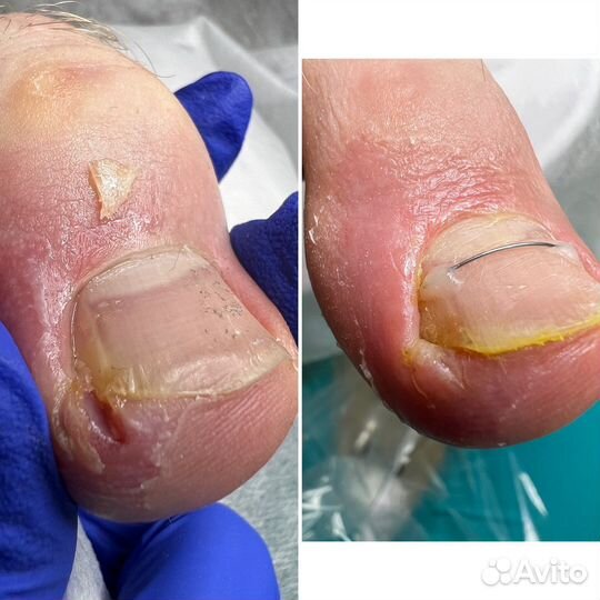 Подолог, мастер педикюра