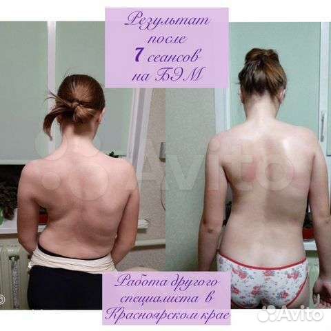 Массаж Биоэнергомассажер(Бэм), массаж, обучение