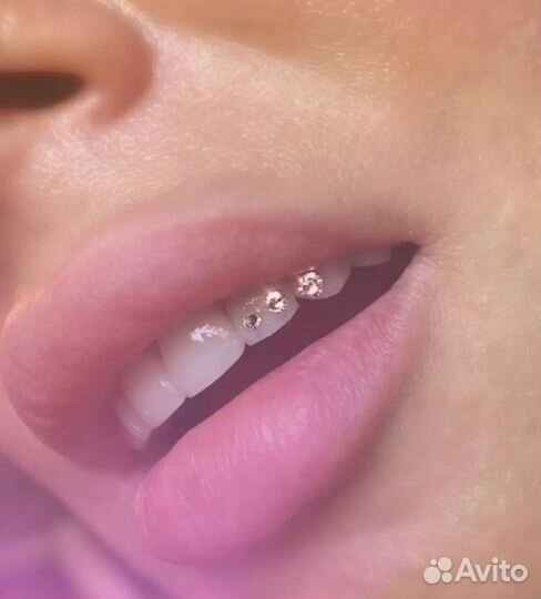 Стразы на зубки(без сверления)безопасный метод