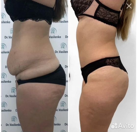 Худей со мной