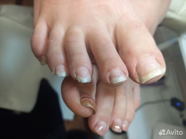 Услуги подолога, педикюр