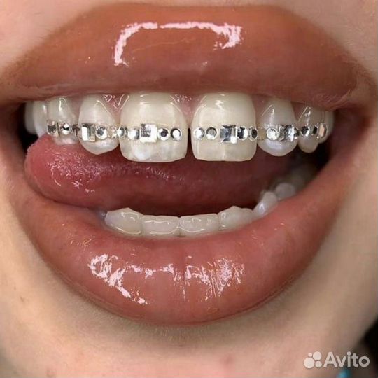 Скайсы на зубы/ установка страз Swarovski