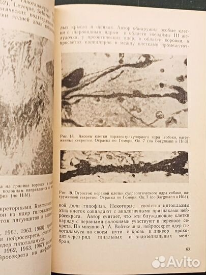 Гипоталамические синдромы. Шефер. 1971