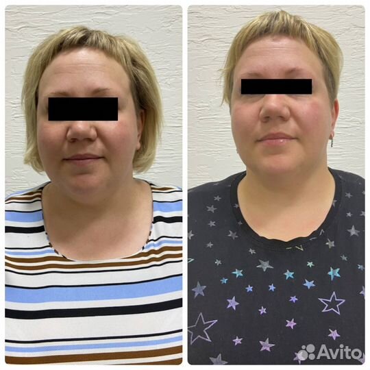 Скульптурирующий массаж лица