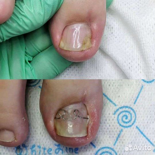 Подолог Педикюр Маникюр