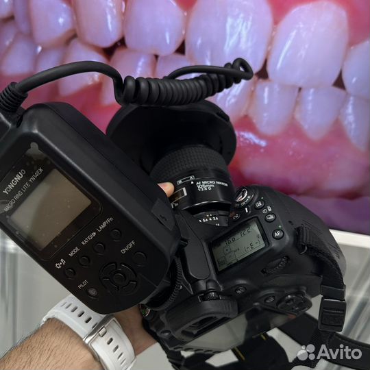 Nikon D90 kit дентальная макро съемка