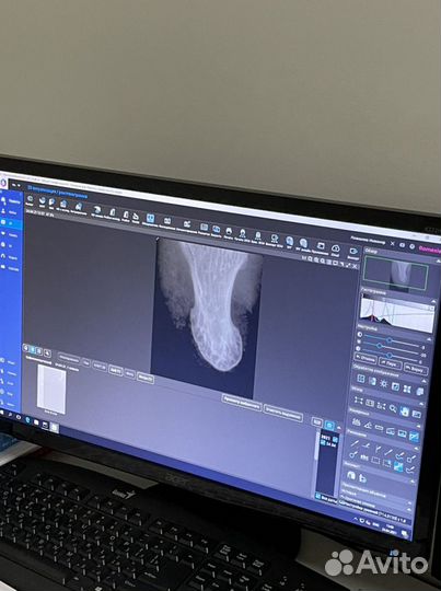 Ремонт медицинского оборудования