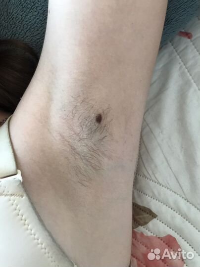 Восковая депиляция