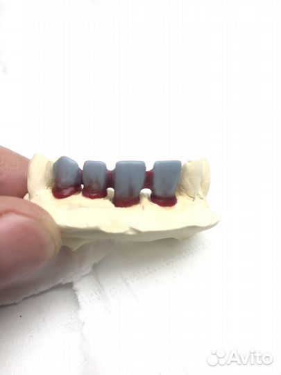 Зуботехническое Литье и Пресс E-Max