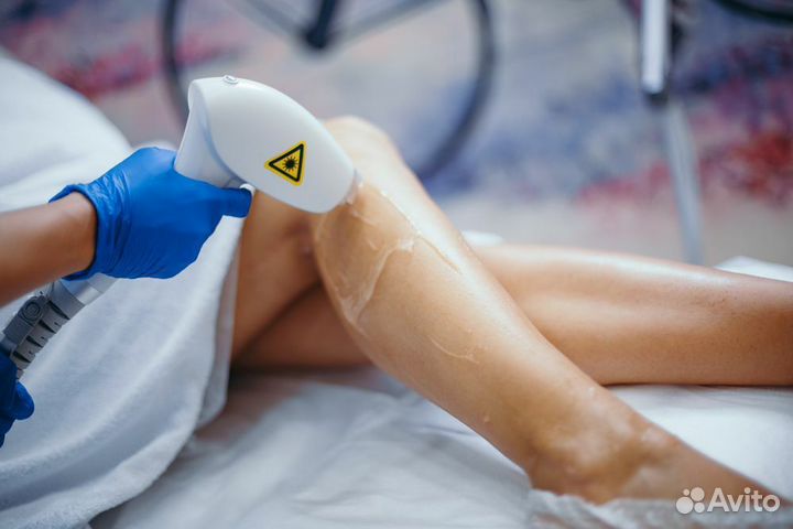 Франшиза лазерной эпиляции под ключ