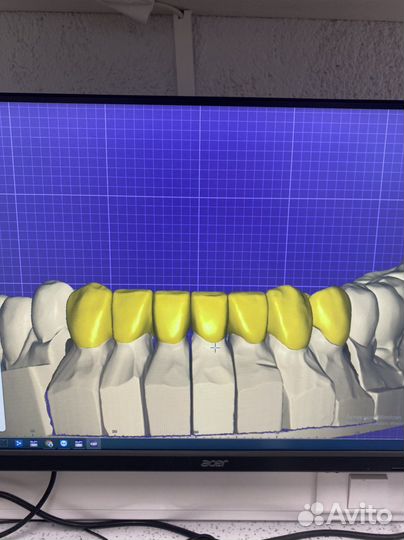 Обучение exocad cad cam