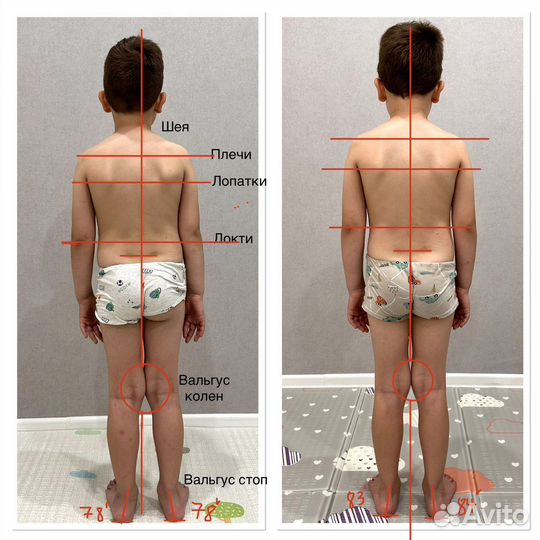 Детский массаж, лфк 0+ (врач-невролог)