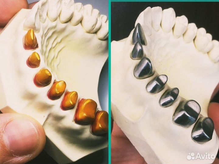 Зубной техник керамист