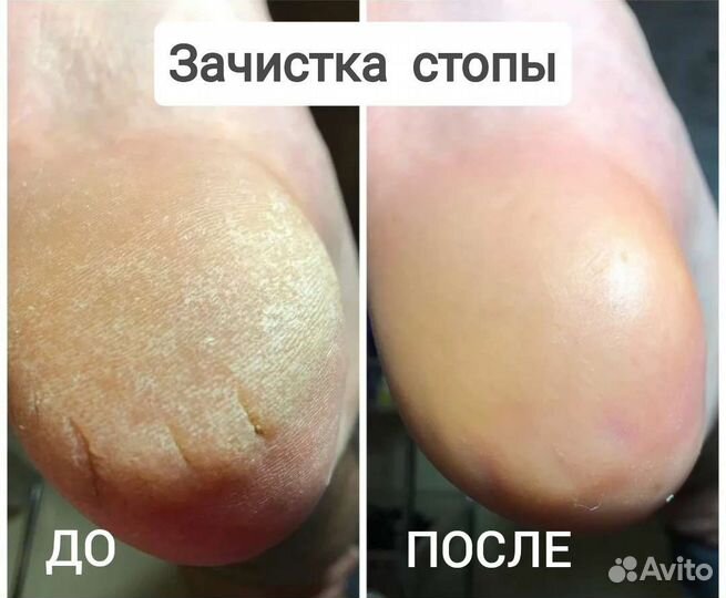 Маникюр/Педикюр ул.Широкая Каневская