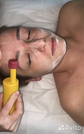 Бмс лица (подтяжка лица, объемные скулы, губы)