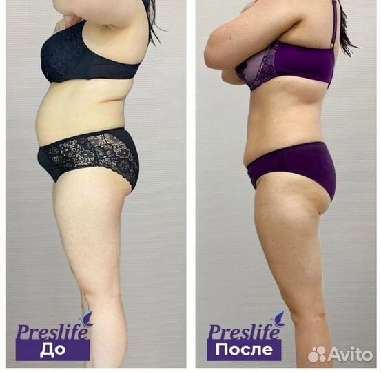 Аппаратная коррекция фигуры. Плoский живот