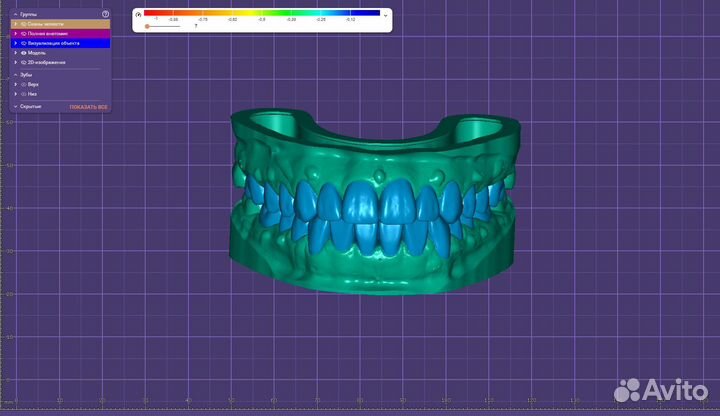 Моделировка в Exocad