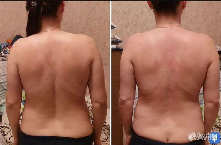 Массаж мануальный Остеопат / Костоправ