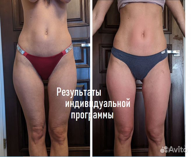 Коррекция фигуры (аппаратная:LPG,Turbo и много др)