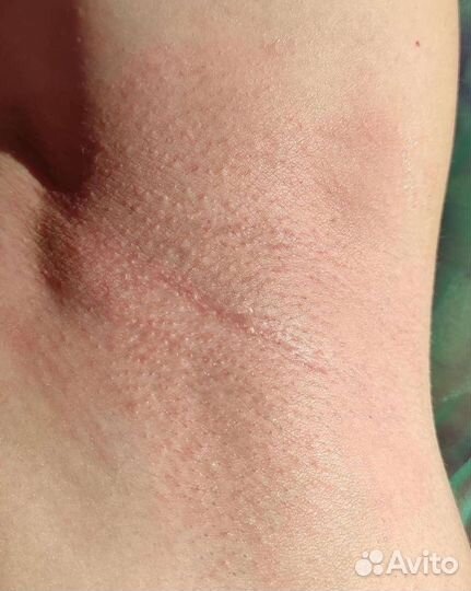 Шугаринг Врангель