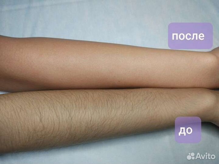 Шугаринг SPA