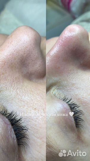 Услуги косметолога