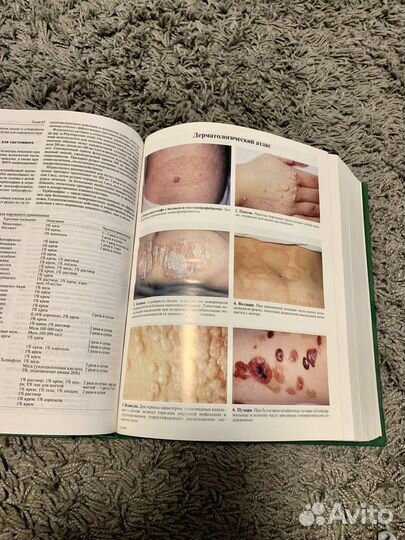 Учебник по терапии, хирургии,инфекционным болезням