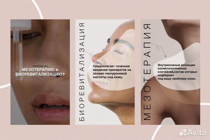 Ведение аккаунта под ключ