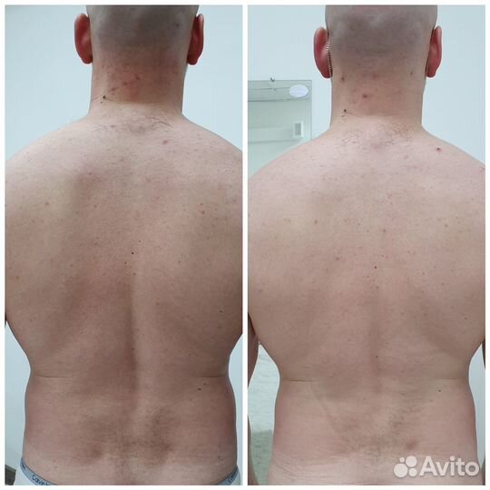 Массаж остеопатический мануальный (костоправ)