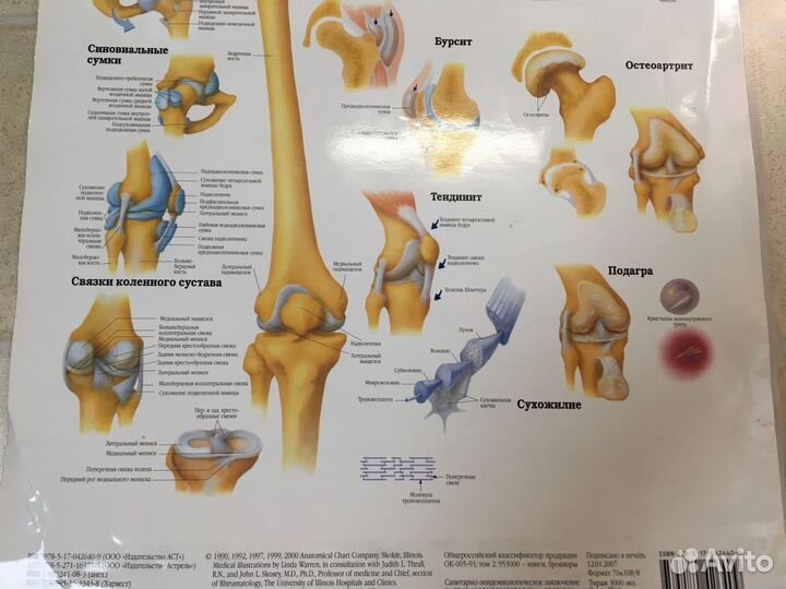 Плакат медицинский артрит 2 стороны