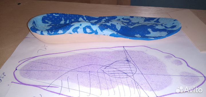 Изготовление индивидуальных стелек