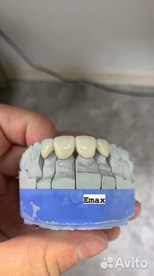 Приглашаю стоматологов ортопедов к сотрудничеству