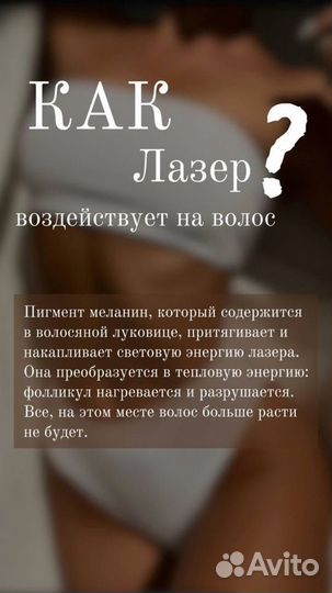 Лазерная эпиляция