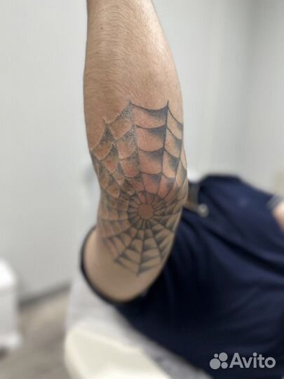 Удаление татуировок и татуажа