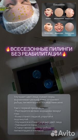 Увеличение губ, ботокс, косметолог, подбородок