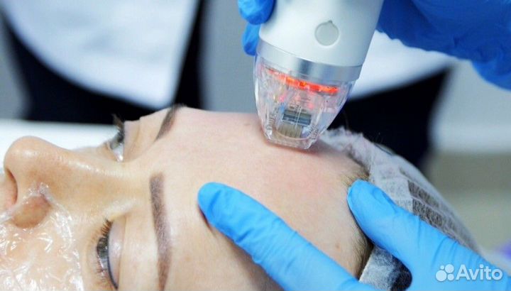 Модель на смас лифтинг\рф игольчатый/рф лифтинг