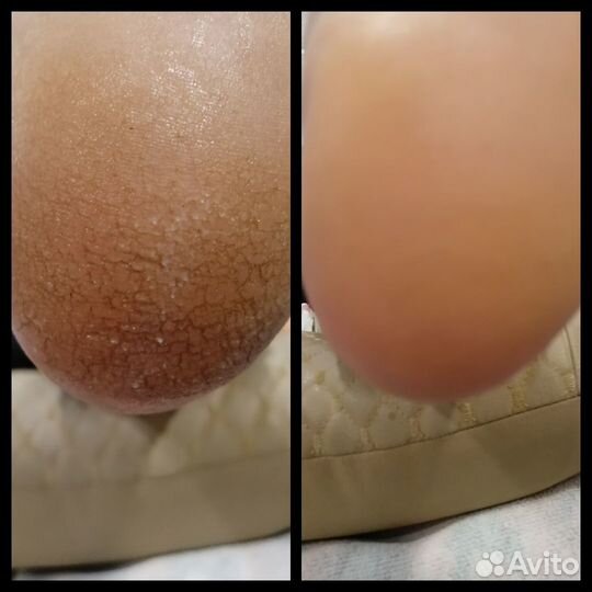 Педикюр в студии